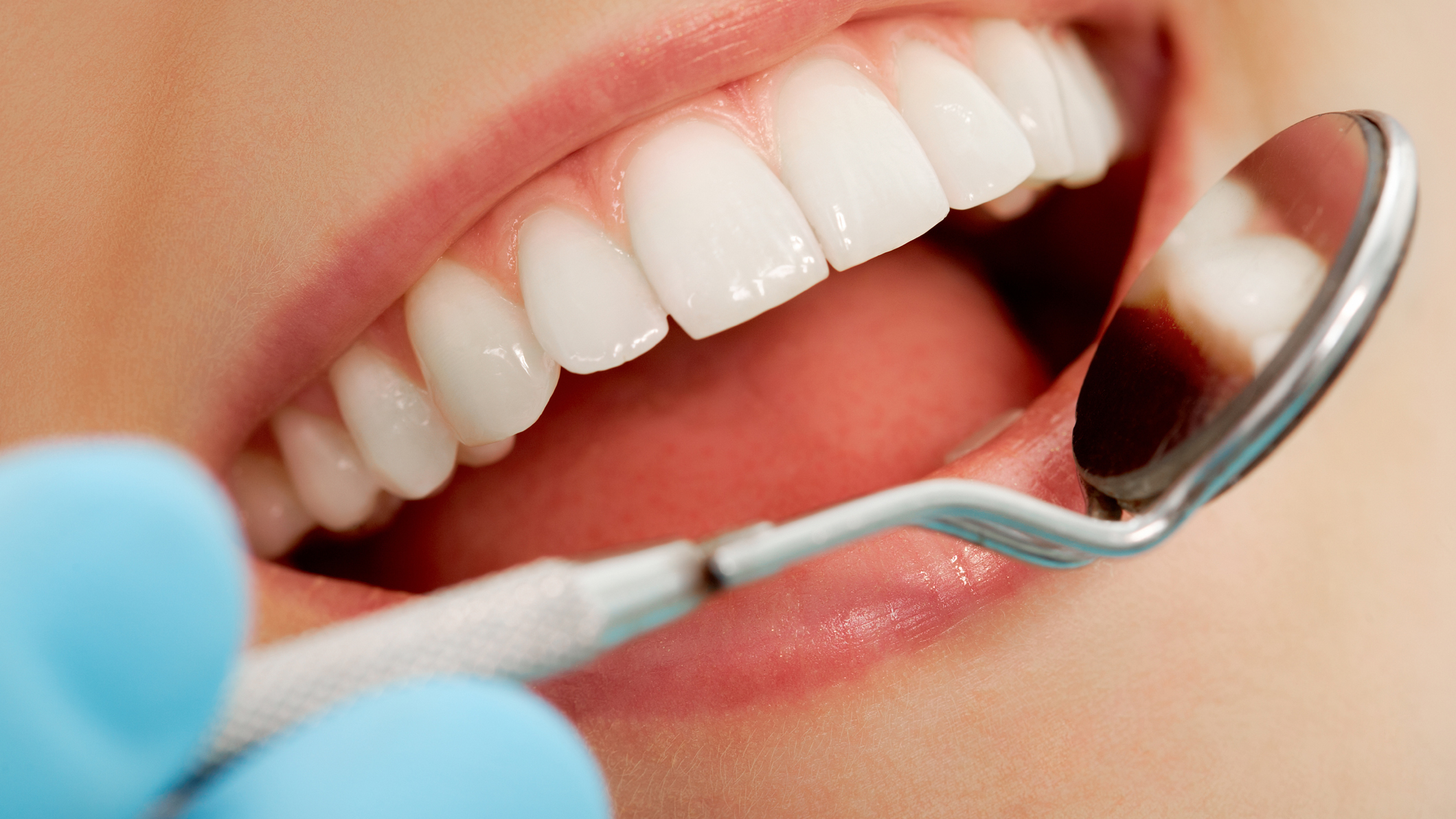 How An Orthodontist Can Improve Your Smile